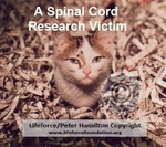 Spinal_Cord_Research_Victim_C